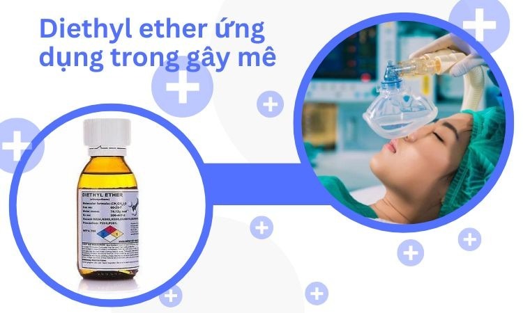 Minh họa 1 ứng dụng của diethyl ether